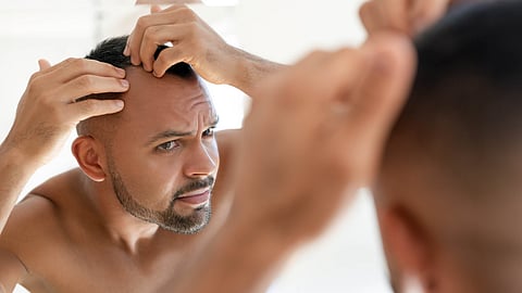 Hair Thinning