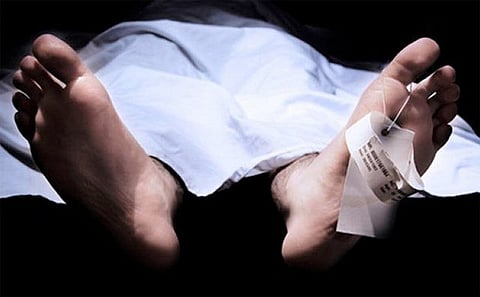 Representative Image