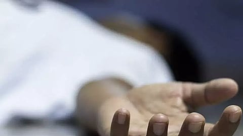 Representative Image