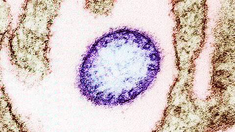 Teen dies of Nipah Virus; Centre to deploy team to probe