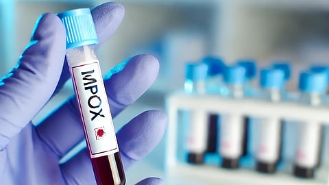 WHO launches plan to stanch mpox transmission; says the virus can be stopped