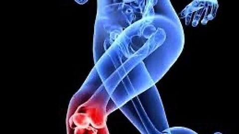 Globally Proven Medial-Pivot Knee Implant Technology Now in Bengaluru