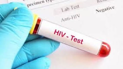 Meghalaya mulling law to make HIV testing mandatory before marriage: Health minister