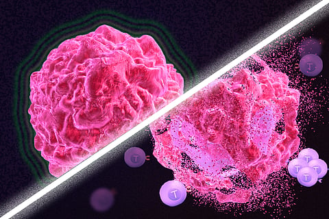 2,443 citizens screened for cancer over 10 days in Thane district, 32 suspected cases flagged