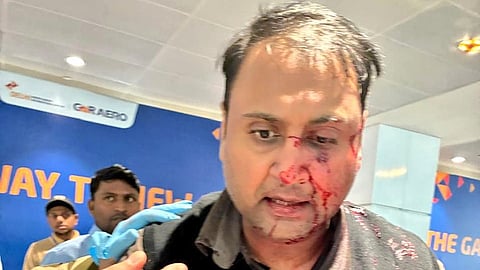 Passenger assaulted at Delhi airport - What happened and why the pilot was grounded