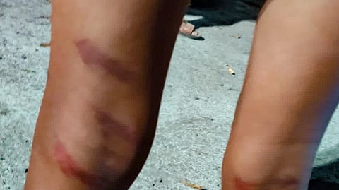 Latur teacher beats 32 students over suspicion of motorbike damage; arrested