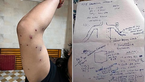 Pellet guns in Delhi? Medical records challenge official narrative on Delhi protest injuries