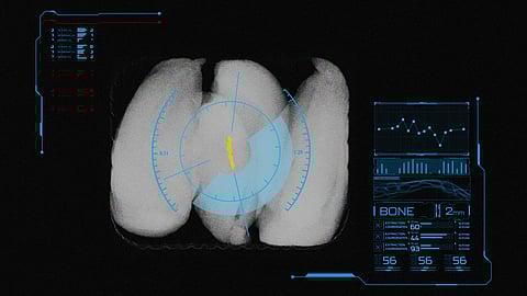 Improve contaminant detection and food safety with Dual Energy X-ray