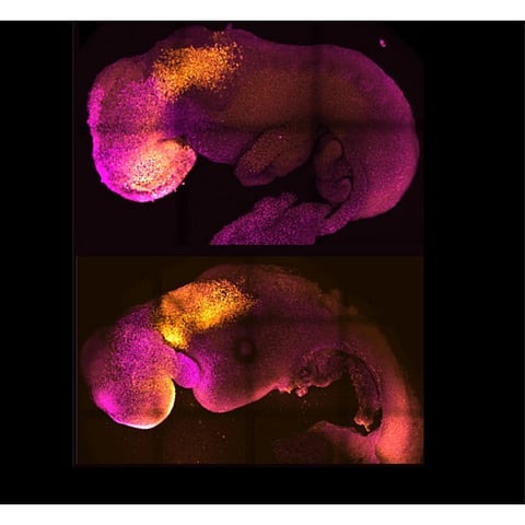 कृत्रिम गर्भ तयार करण्यात संशोधकांना यश; निपुत्रिक दाम्पत्यांच्या आशा पल्लवित