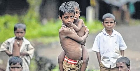 नंदूरबारला कुपोषणामुळे ८६ बालकांचा मृत्यू