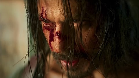 शुटिंगदरम्यान किंग खान जखमी ; शस्त्रक्रिया करुन भारतात परतला