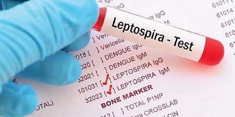 लेप्टोचा प्रसार रोखण्यासाठी पालिकेचा प्लॅन ४-डी