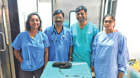 युवतीची ‘हेअर बॉल ट्यूमर’पासून सुटका! वसईतील ज्येष्ठ शल्यविशारद डॉ. जोसेफ डिसोजा आणि टीमच्या प्रयत्नांना यश