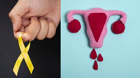 Irregular menstruation can lead to cancer risk