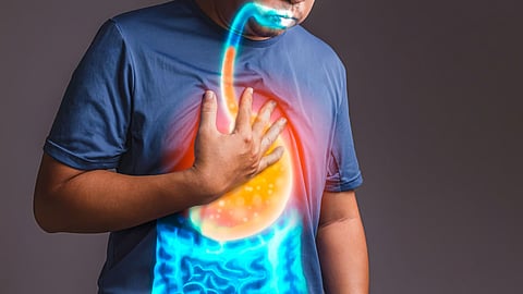 Acidity: तुम्हाला सतत ॲसिडीटी होते? आराम मिळवण्यासाठी फॉलो करा 'या' टिप्स