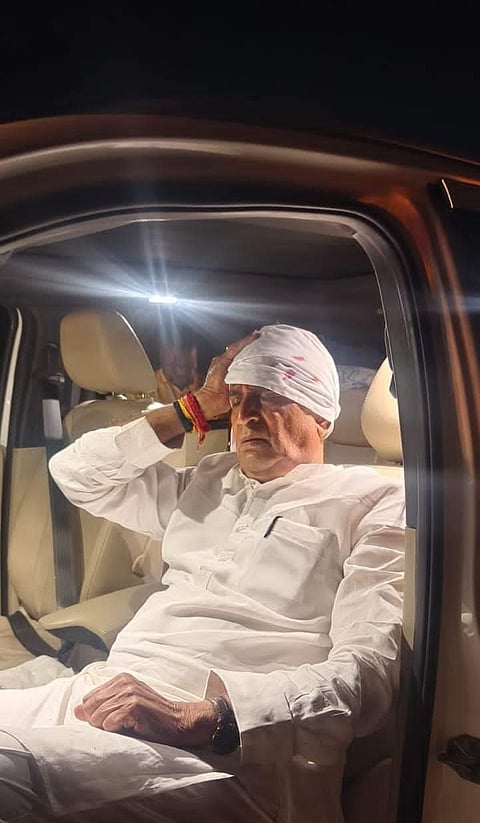 अनिल देशमुख यांच्या गाडीवर दगडफेक; गंभीर जखमी