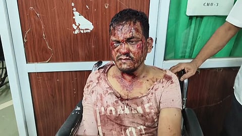 उल्हासनगर : नशेबाज तरुणांचा हैदोस, व्यक्तीवर जीवघेणा हल्ला!