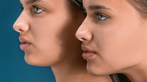 Double Chin मुळे त्रस्त आहात; सेल्फीसुद्धा घ्यावासा वाटत नाही? हे सोपे पण प्रभावी व्यायाम करा आणि पाहा फरक