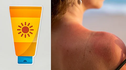 Sunscreen Side Effect : उन्हापासून बचावासाठी सनस्क्रीन वापरताय? सावधान... होऊ शकतात हे दुष्परिणाम