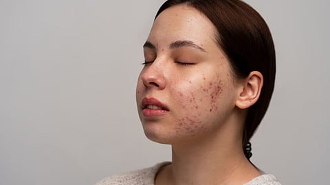 बॉडी डिटॉक्स म्हणजे काय? कोणते संकेत दर्शवतात शरीराच्या अंतर्गत स्वच्छतेची गरज; काय आहेत फायदे?