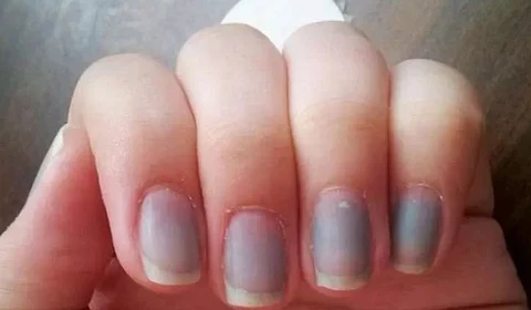 सावधान! निळी नखं असू शकतात गंभीर आजाराचे लक्षण