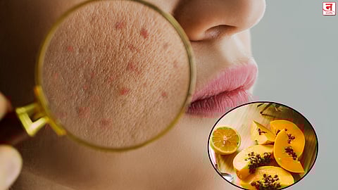 डेड स्किनला म्हणा बाय-बाय; पपईचा फेस पॅक देईल तजेलदार त्वचा!