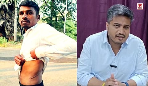 कर्ज फेडण्यासाठी शेतकऱ्याने किडनी विकली; रोहित पवार आक्रमक, "या निर्दयी सरकारवर...