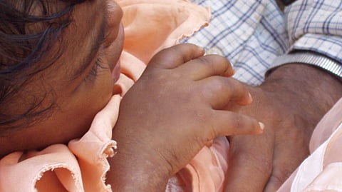 राज्यात सिकलसेल आजाराचे १२ हजारांहून अधिक रुग्ण | प्रातिनिधिक छायाचित्र