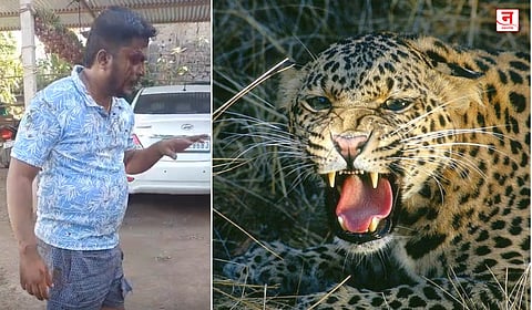 कराडजवळील शहापूर येथे बिबट्याचा हल्ला; युवक गंभीर जखमी, परिसरात भीतीचे वातावरण