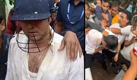 Kolkata : अभिषेक बॅनर्जीवर दगड, अंड्यांनी हल्ला