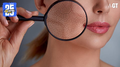 Picture for reference purpose only.