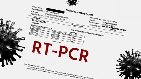 Explaining terms like CT Value and Target Genes that are usually mentioned in the RT-PCR reports (The Bridge Chronicle)