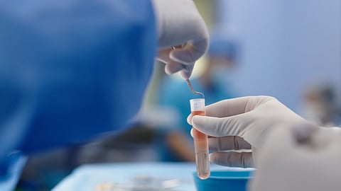 Abu Dhabi Stem Cells Centre pioneers testicular cryopreservation for four boys