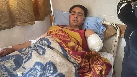 Due to the severity of his injuries, doctors were forced to amputate his left arm.