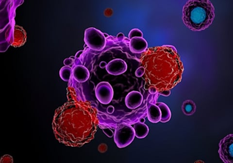 Stem cell therapy safe, and effective in treating Parkinson