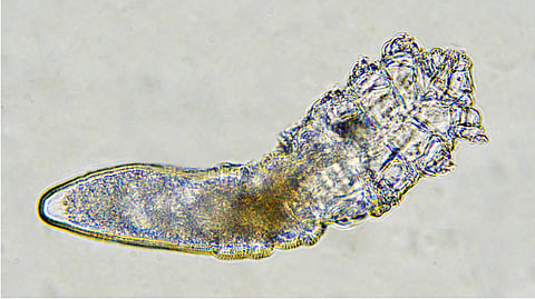 Demodex face mites eat skin oils (sebum) and live inside your hair follicles and sebaceous glands.
They are nocturnal parasites — coming out only at night before slipping back into your pores by morning.