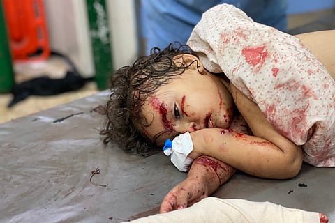 A girl receives treatment for her wounds, sustained in an Israeli strike on a camp housing displaced Palestinians, at Khan Yunis' Nasser hospital in the southern Gaza Strip on July 2, 2025.