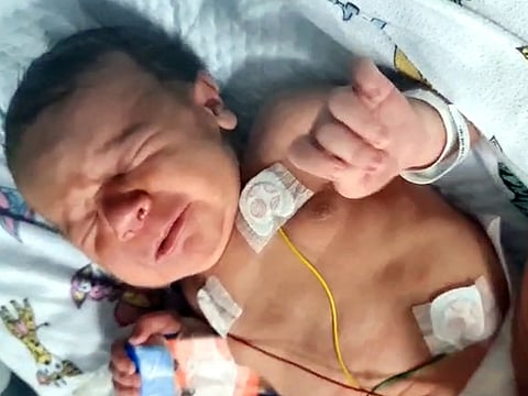 Hero aunt saves five-month-old baby in UAE’s youngest liver transplant