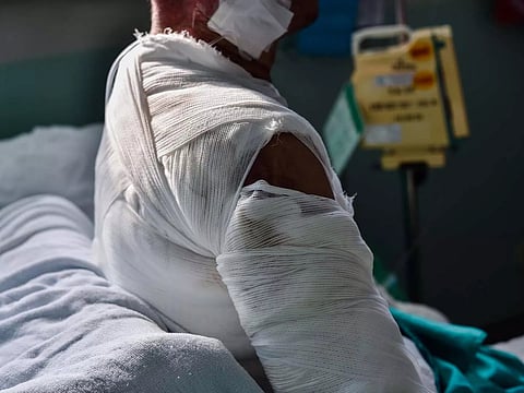 Photo for illustration purposes only