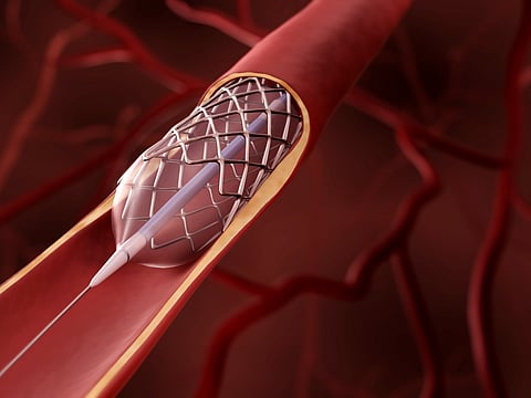 Next-generation cardiac treatments: From nanotech to interventional excellence