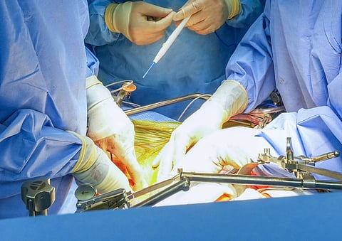 After suffering four days of abdominal pain, the unnamed teen was taken to Tauranga Hospital on the North Island. For illustrative purposes only.