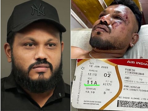 Viswash Kumar Ramesh, Air India Flight 171 crash’s sole survivor shares his story.