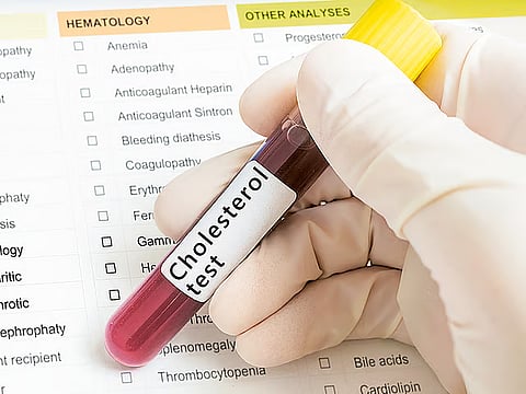 Over half of UAE adults have high cholesterol, 96% exceed sodium intake, national survey reveals