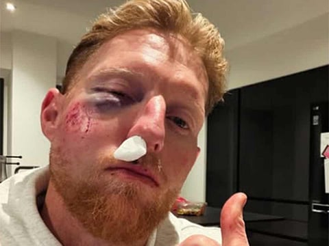 Injured Ben Stokes