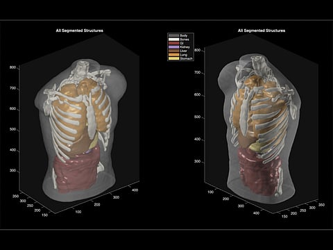 Unlike MRI or CT scans, the system relies on dozens of ultrasound sensors arranged in a ring around the body.