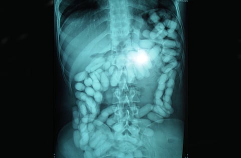 Supplied by Royal Oman Police