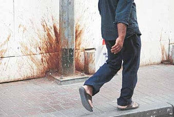 Spitting in public is as bad as vandalism