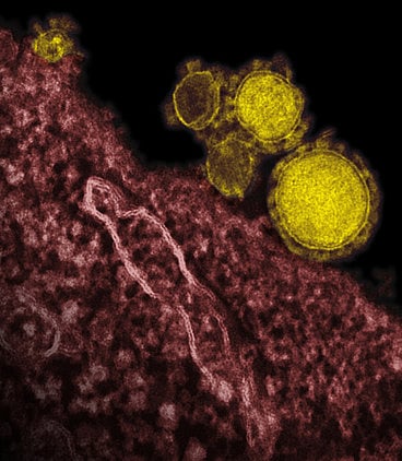 This undated electron microscope image made availalbe by the National Institute of Allergy and Infections Diseases - Rocky Mountain Laboratories shows novel coronavirus particles. Saudi Center for Disease Control and Prevention said in a tweet that there were no cases of the novel coronavirus so far in Saudi Arabia.