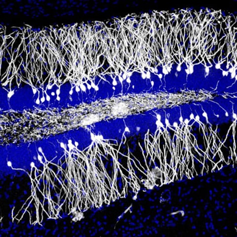 New nerve cells erase old memories