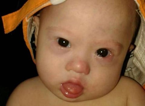 Courtesy: Hope for gammy